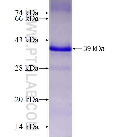 AR fusion protein Ag17385 SDS-PAGE