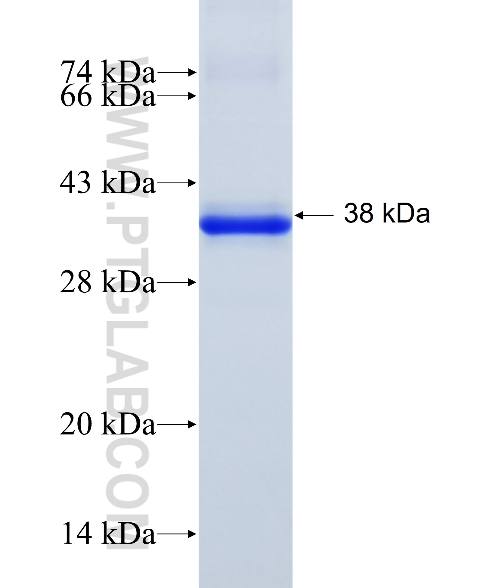 AR fusion protein Ag17385 SDS-PAGE