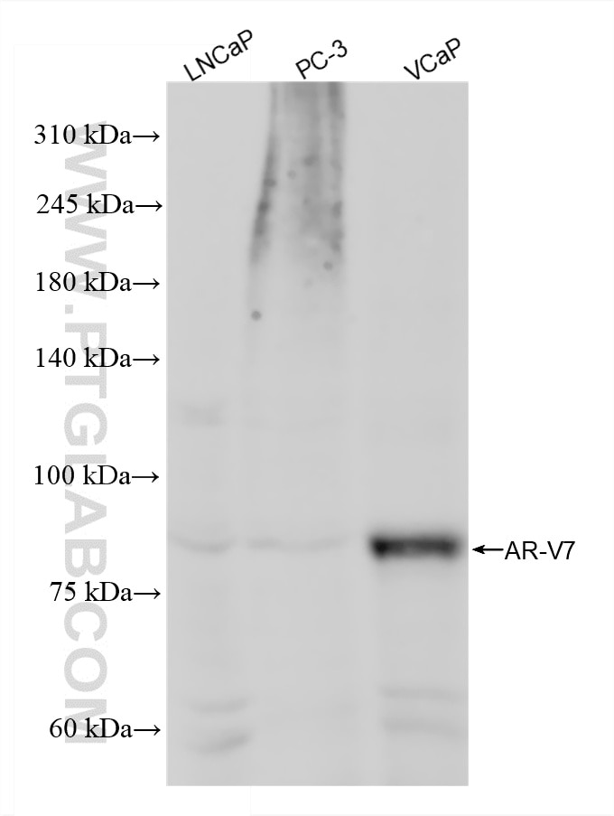 WB analysis using 81847-2-RR (same clone as 81847-2-PBS) Western Blot (WB) analysis of various lysates using AR-V7 Recombinant monoclonal antibody (81847-2-RR)
