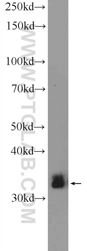 Western Blot (WB) analysis of HeLa cells using ARAF Polyclonal antibody (22129-1-AP)