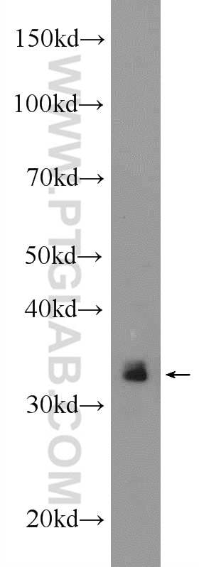 Western Blot (WB) analysis of A431 cells using ARAF Polyclonal antibody (22129-1-AP)
