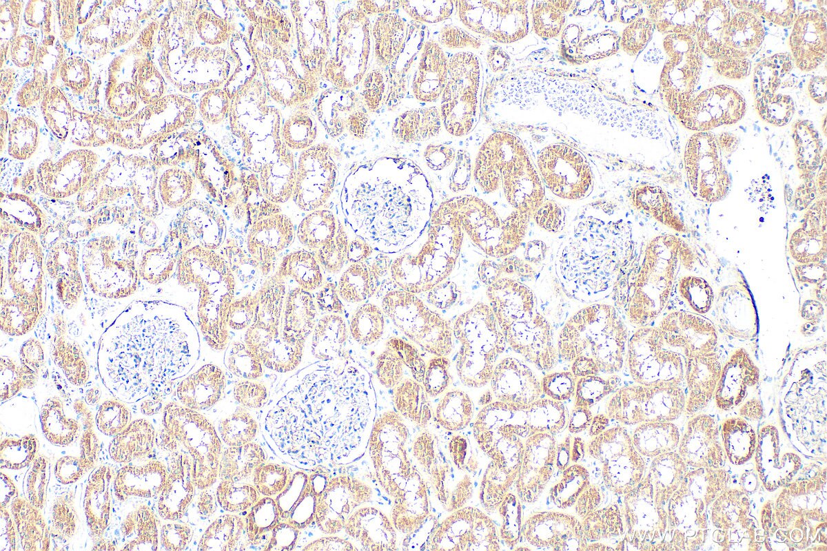 Immunohistochemistry (IHC) staining of human kidney tissue using ARAP1 Polyclonal antibody (17541-1-AP)