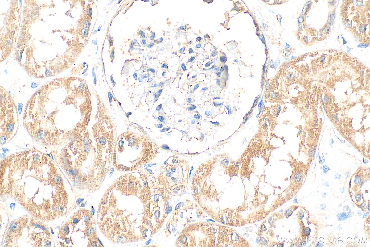 Immunohistochemistry (IHC) staining of human kidney tissue using ARAP1 Polyclonal antibody (17541-1-AP)