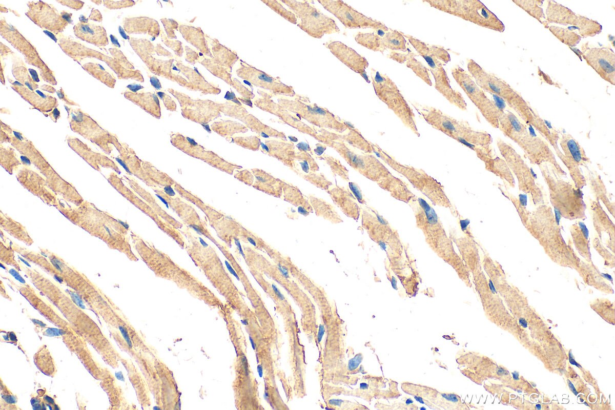 Immunohistochemistry (IHC) staining of mouse heart tissue using ARAP1 Polyclonal antibody (17541-1-AP)