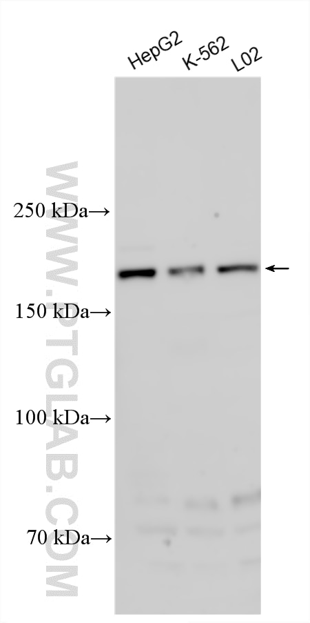 Western Blot (WB) analysis of various lysates using ARAP1 Polyclonal antibody (17541-1-AP)