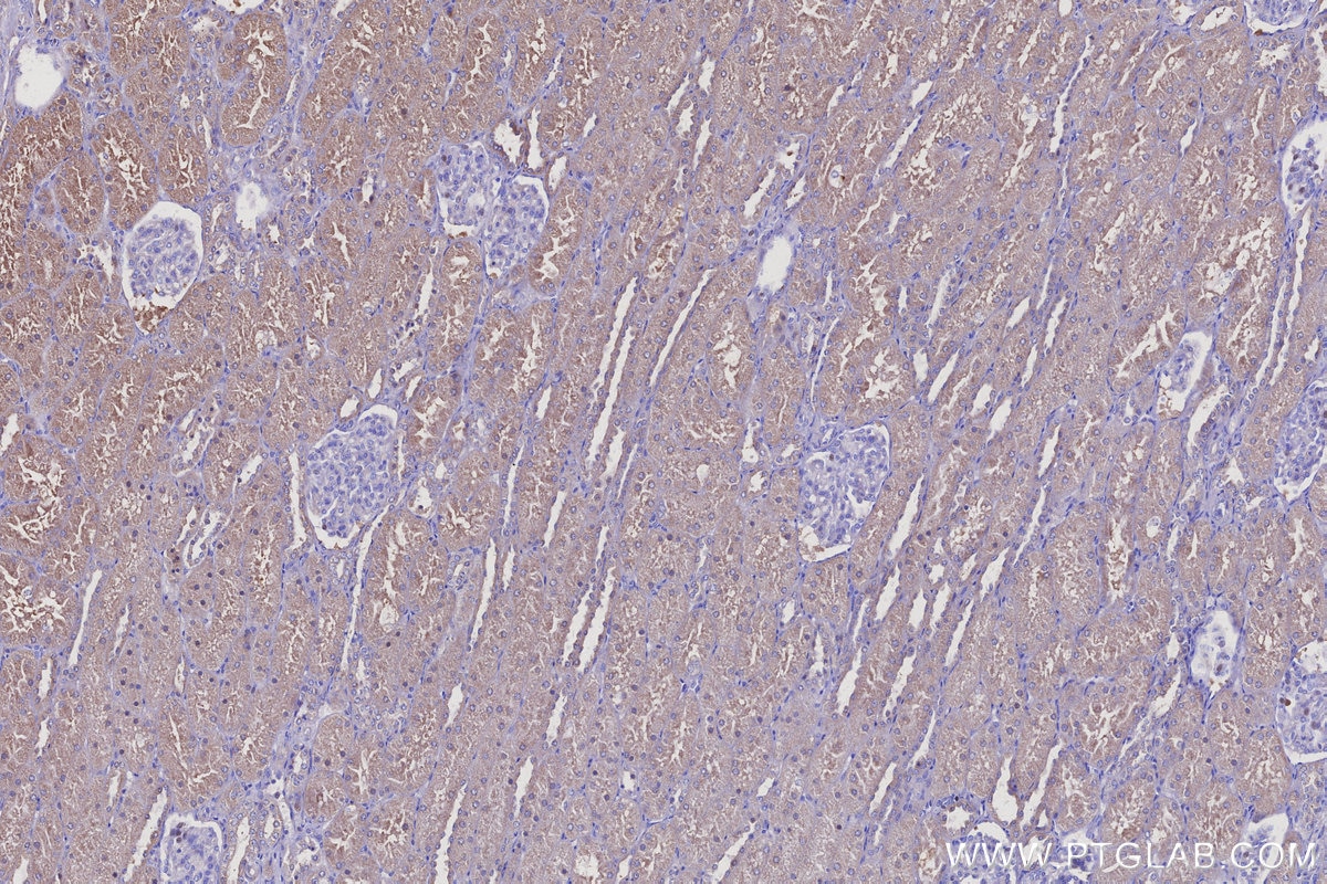Immunohistochemistry (IHC) staining of human kidney tissue using ARAP2 Polyclonal antibody (25143-1-AP)