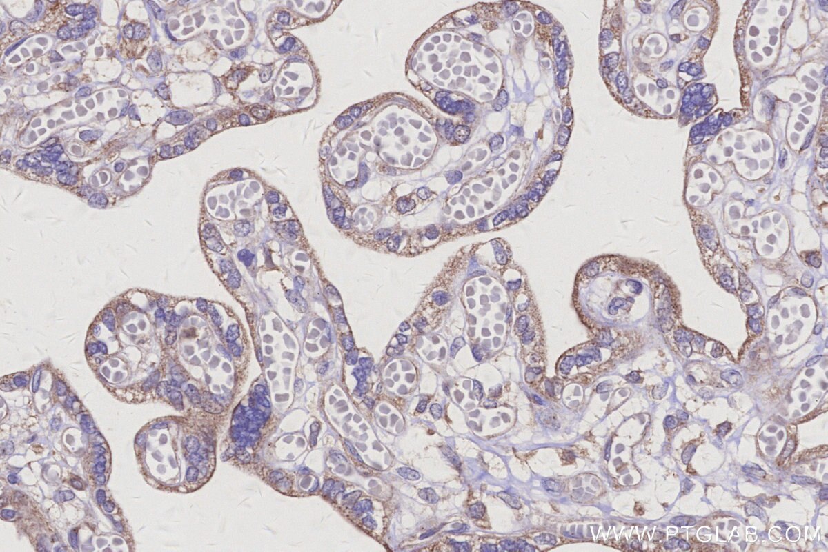 Immunohistochemistry (IHC) staining of human placenta tissue using ARAP2 Polyclonal antibody (25143-1-AP)