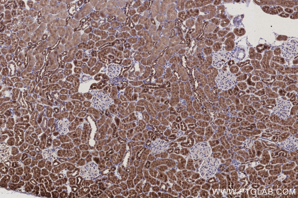 Immunohistochemistry (IHC) staining of rat kidney tissue using ARAP2 Polyclonal antibody (25143-1-AP)
