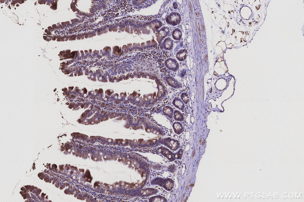 Immunohistochemistry (IHC) staining of rat small intestine tissue using ARAP2 Polyclonal antibody (25143-1-AP)