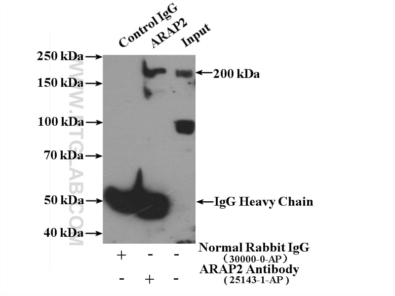 Immunoprecipitation (IP) experiment of mouse brain tissue using ARAP2 Polyclonal antibody (25143-1-AP)