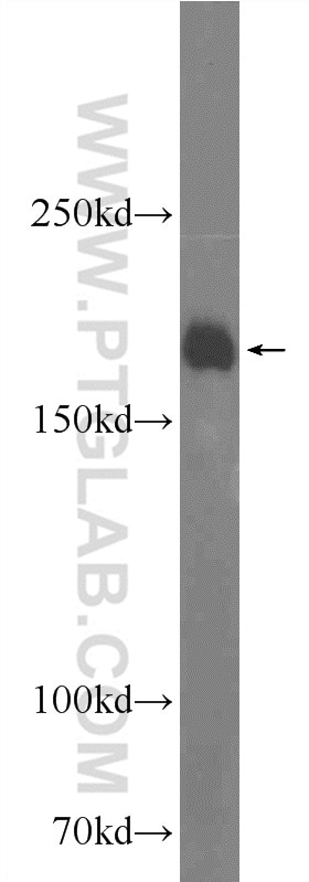 WB analysis of mouse brain using 25143-1-AP