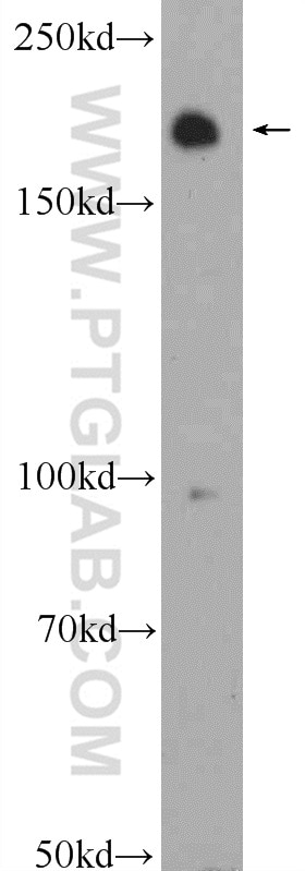 Western Blot (WB) analysis of rat brain tissue using ARAP2 Polyclonal antibody (25143-1-AP)