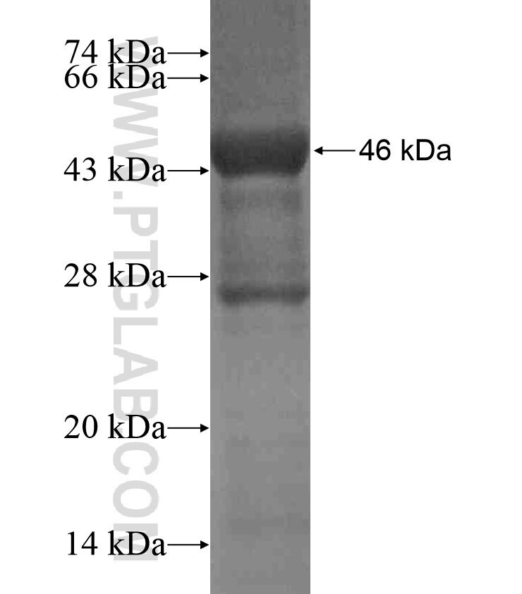ARAP2 fusion protein Ag18469 SDS-PAGE