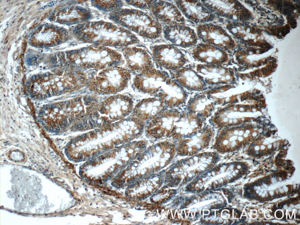 Immunohistochemistry (IHC) staining of human colon tissue using ARAP3 Polyclonal antibody (22578-1-AP)