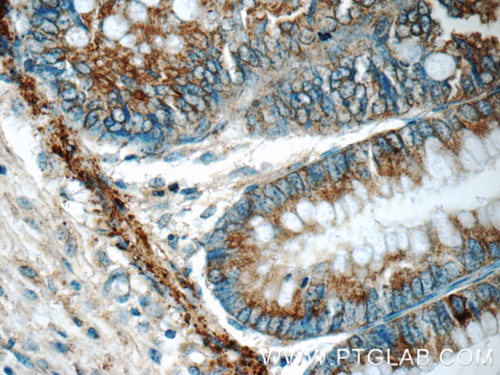 Immunohistochemistry (IHC) staining of human colon tissue using ARAP3 Polyclonal antibody (22578-1-AP)