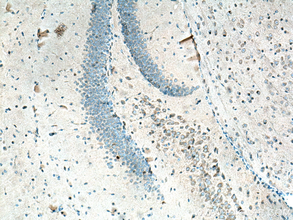 Immunohistochemistry (IHC) staining of mouse brain tissue using ARC/ARG3.1 Polyclonal antibody (16290-1-AP)