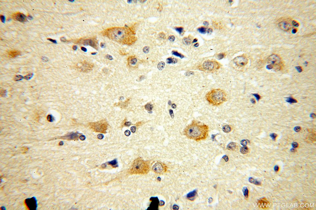 Immunohistochemistry (IHC) staining of human brain tissue using ARC/ARG3.1 Polyclonal antibody (16290-1-AP)