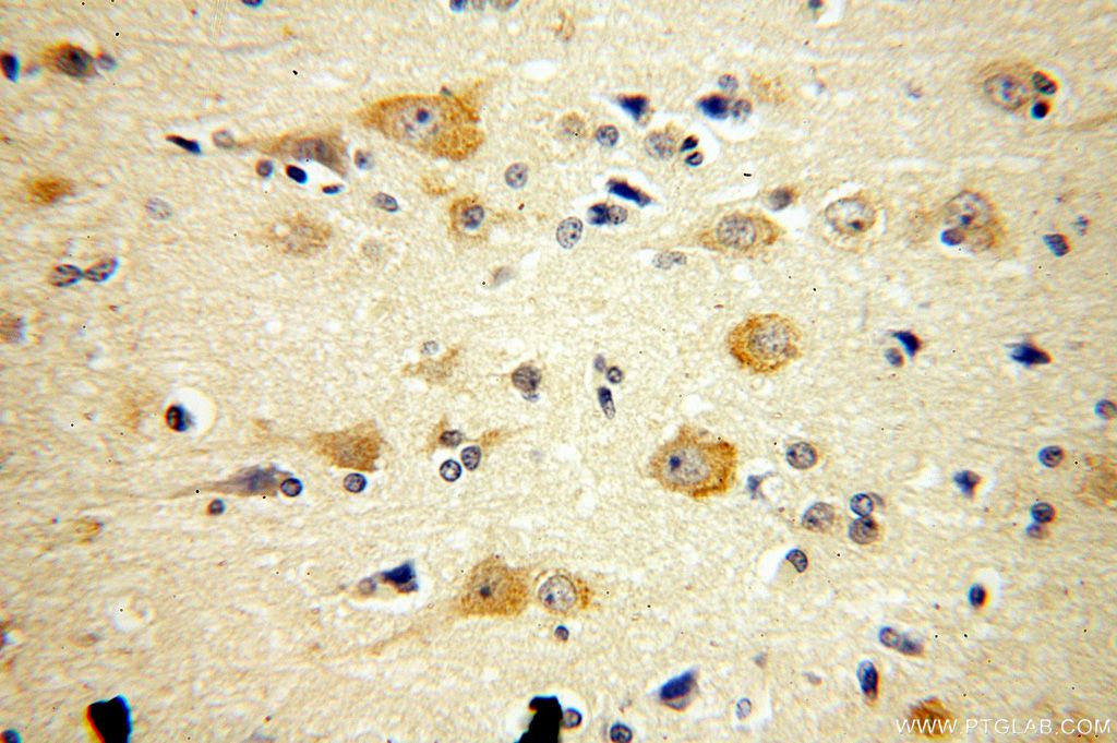 IHC staining of human brain using 16290-1-AP