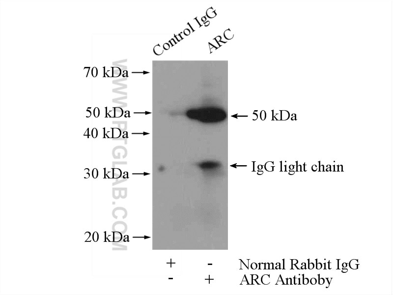 Immunoprecipitation (IP) experiment of mouse brain tissue using ARC/ARG3.1 Polyclonal antibody (16290-1-AP)