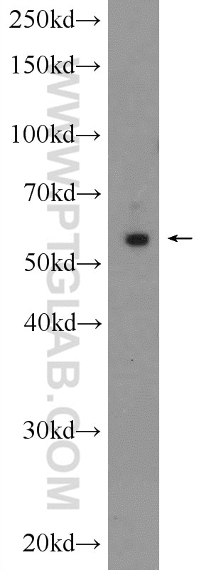 Western Blot (WB) analysis of rat heart tissue using ARC/ARG3.1 Polyclonal antibody (16290-1-AP)