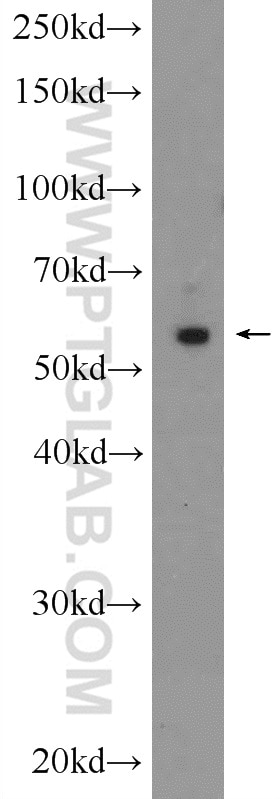 WB analysis of rat heart using 16290-1-AP