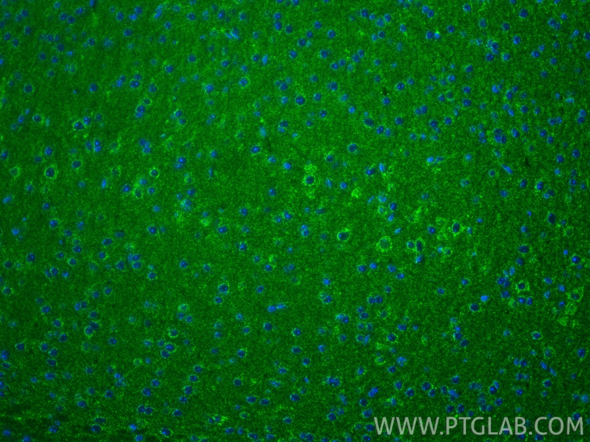 IF Staining of mouse brain using 66550-1-Ig Immunofluorescence (IF) / fluorescent staining of mouse brain tissue using ARC Monoclonal antibody (66550-1-Ig)
