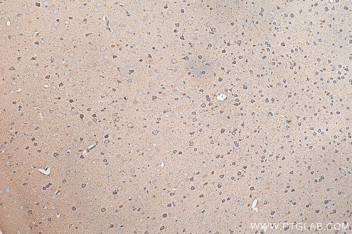 Immunohistochemistry (IHC) staining of mouse brain tissue using ARC Monoclonal antibody (66550-1-Ig)