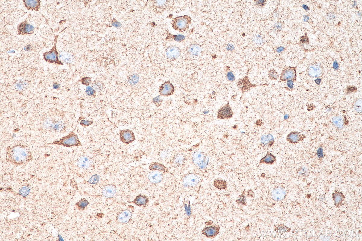 IHC staining of mouse brain using 66550-1-Ig