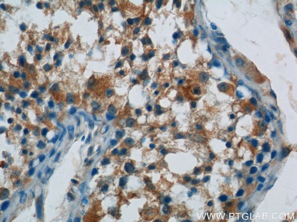 Immunohistochemistry (IHC) staining of human testis tissue using ARCN1 Polyclonal antibody (23843-1-AP)