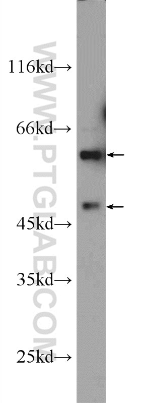 Western Blot (WB) analysis of HepG2 cells using ARCN1 Polyclonal antibody (23843-1-AP)