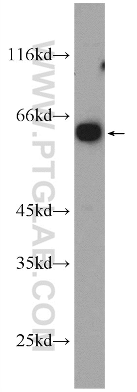 Western Blot (WB) analysis of mouse pancreas tissue using ARCN1 Polyclonal antibody (23843-1-AP)