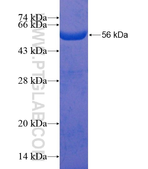 ARCN1 fusion protein Ag20836 SDS-PAGE