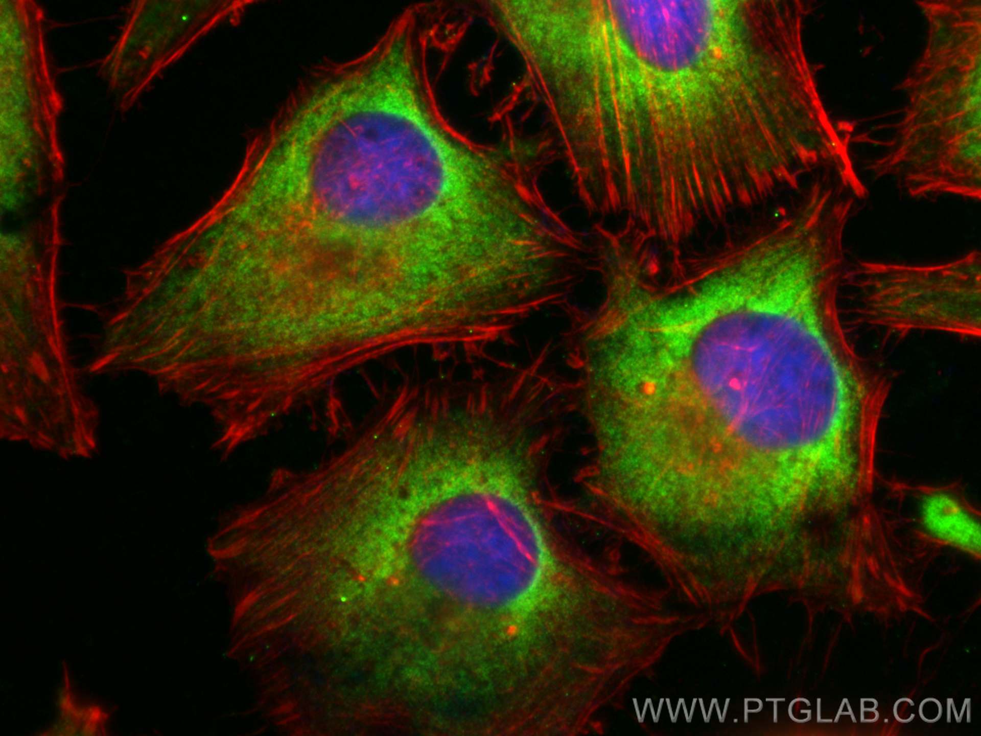Immunofluorescence (IF) / fluorescent staining of HeLa cells using ARD1A Polyclonal antibody (14803-1-AP)