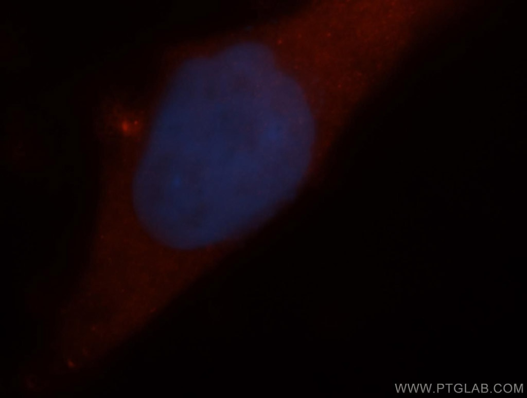 Immunofluorescence (IF) / fluorescent staining of MCF-7 cells using ARD1A Polyclonal antibody (14803-1-AP)