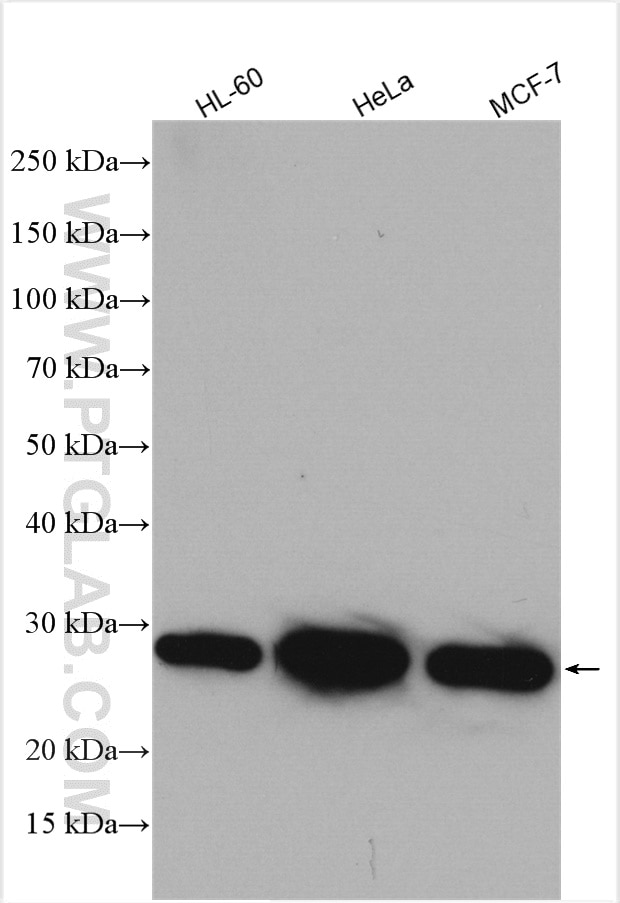 Western Blot (WB) analysis of various lysates using ARD1A Polyclonal antibody (14803-1-AP)