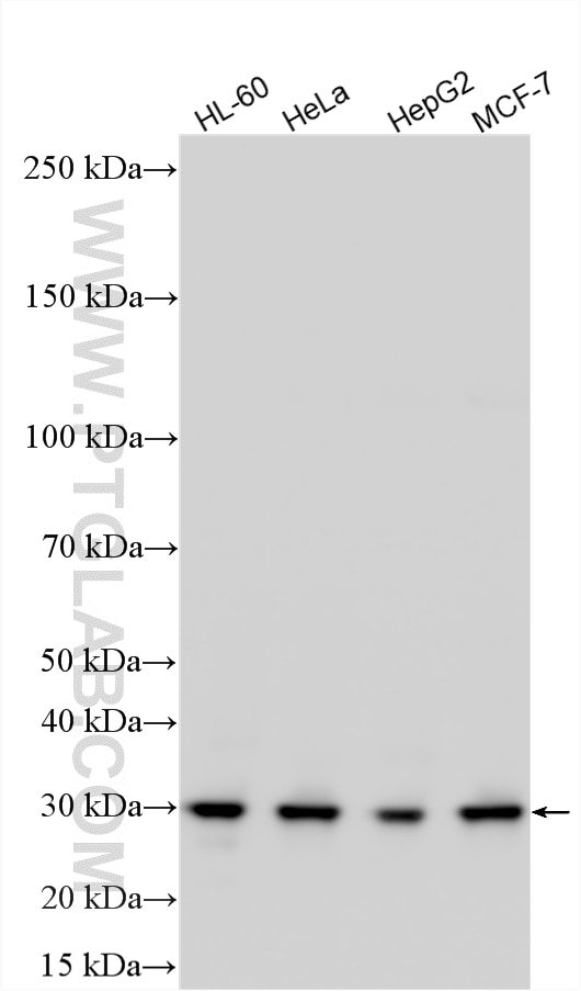 Western Blot (WB) analysis of various lysates using ARD1A Polyclonal antibody (14803-1-AP)