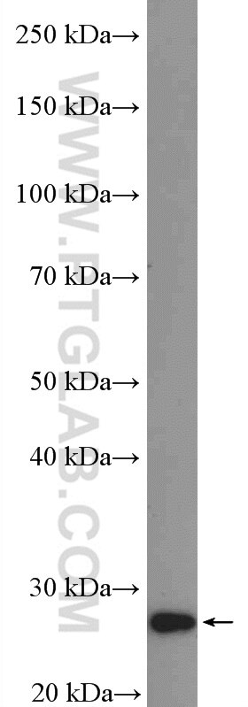 Western Blot (WB) analysis of mouse spleen tissue using ARD1A Polyclonal antibody (14803-1-AP)