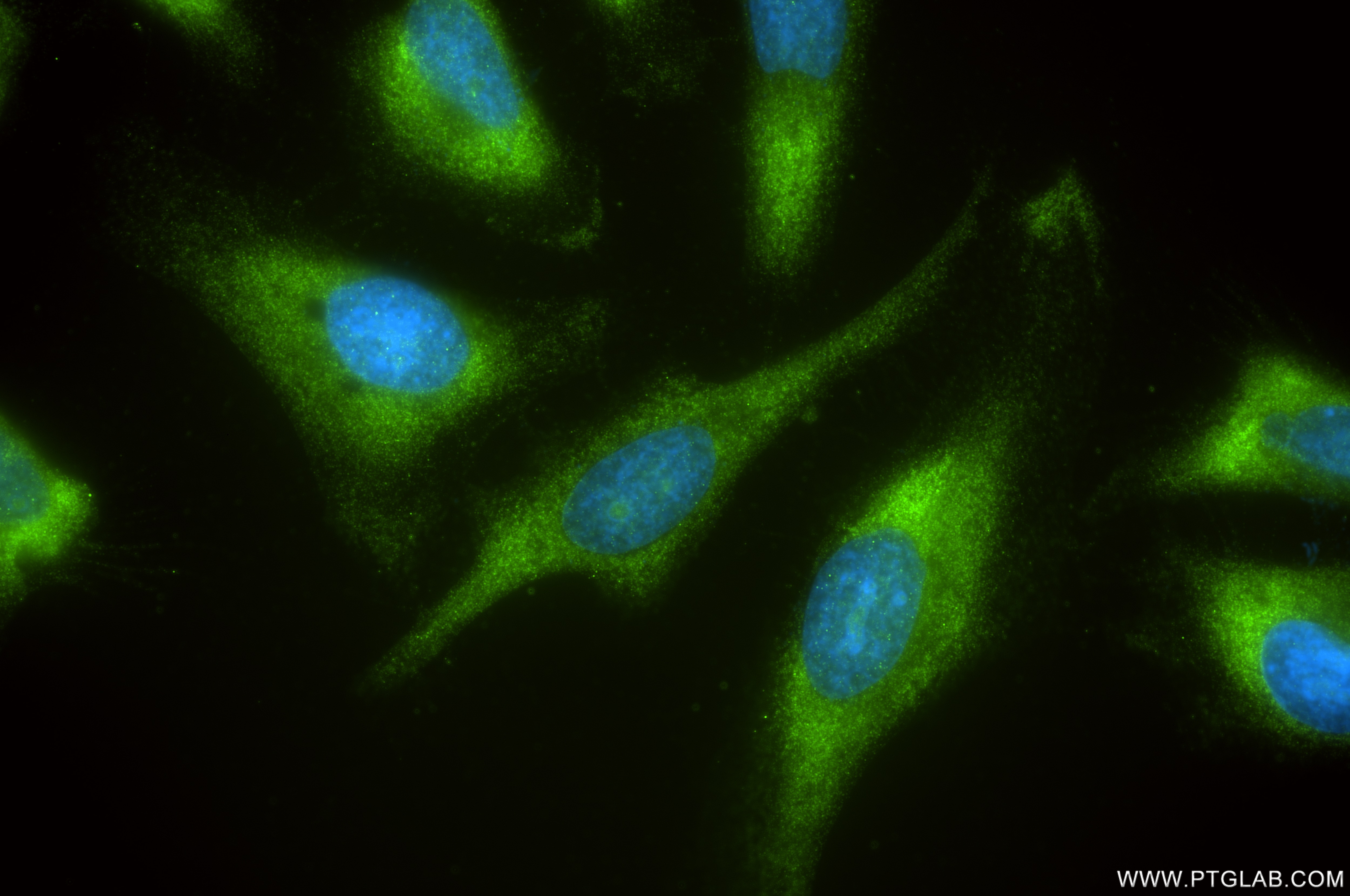 Immunofluorescence (IF) / fluorescent staining of HeLa cells using ARD1A Recombinant antibody (86450-3-RR)
