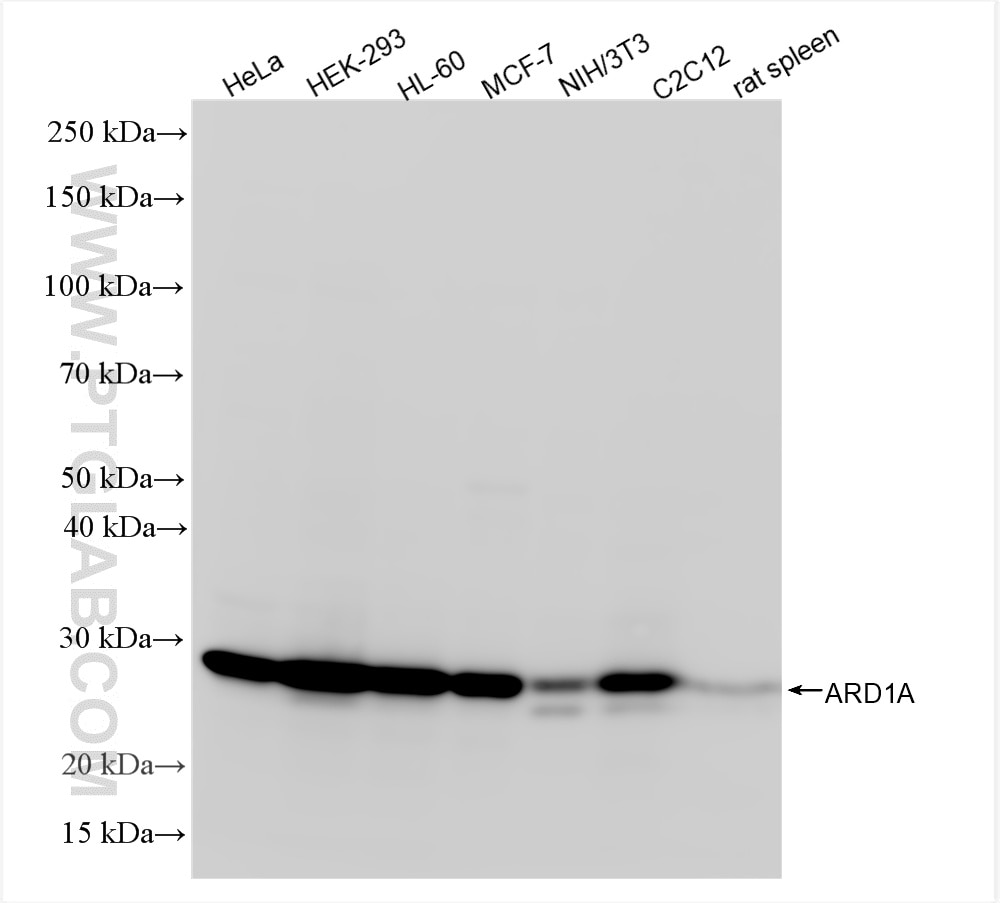 Western Blot (WB) analysis of various lysates using ARD1A Recombinant antibody (86450-3-RR)