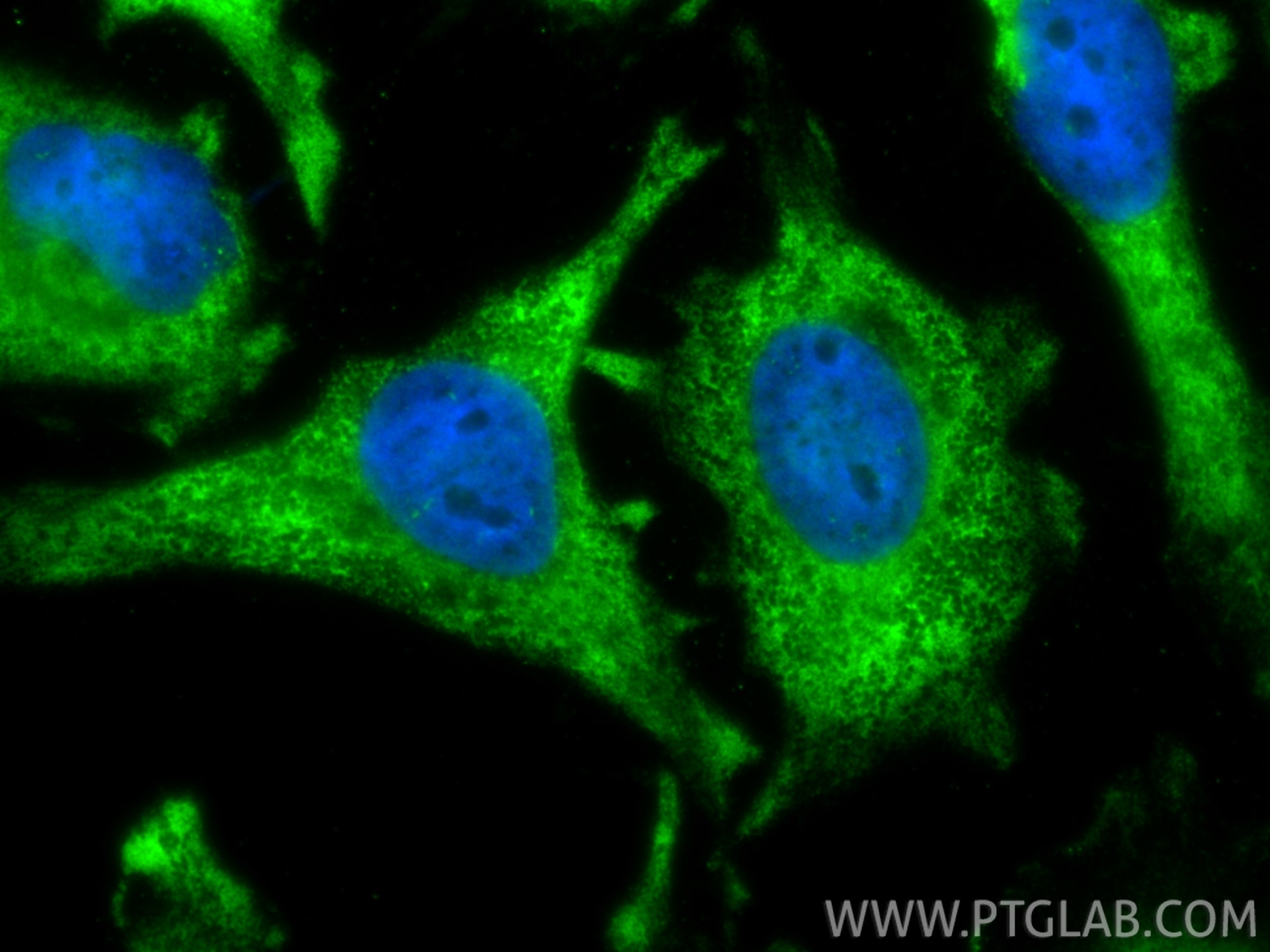 Immunofluorescent analysis of (-20°C Ethanol) fixed HeLa cells using CoraLite® Plus 488 ARD1A antibody (CL488-86450-3, Clone: 251237F2 ) at dilution of 1:200. Immunofluorescence (IF) / fluorescent staining of HeLa cells using CoraLite® Plus 488-conjugated ARD1A Recombinant mo (CL488-86450-3)