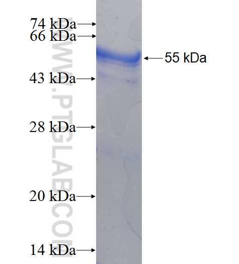 ARD1A fusion protein Ag6519 SDS-PAGE