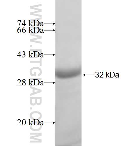 ARD1A fusion protein Ag7406 SDS-PAGE