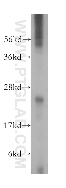 Western Blot (WB) analysis of mouse testis tissue using ARD1B Polyclonal antibody (15670-1-AP)