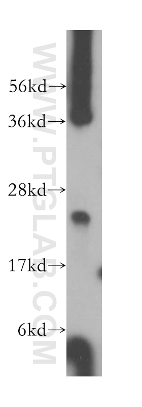 Western Blot (WB) analysis of mouse testis tissue using ARD1B Polyclonal antibody (15670-1-AP)