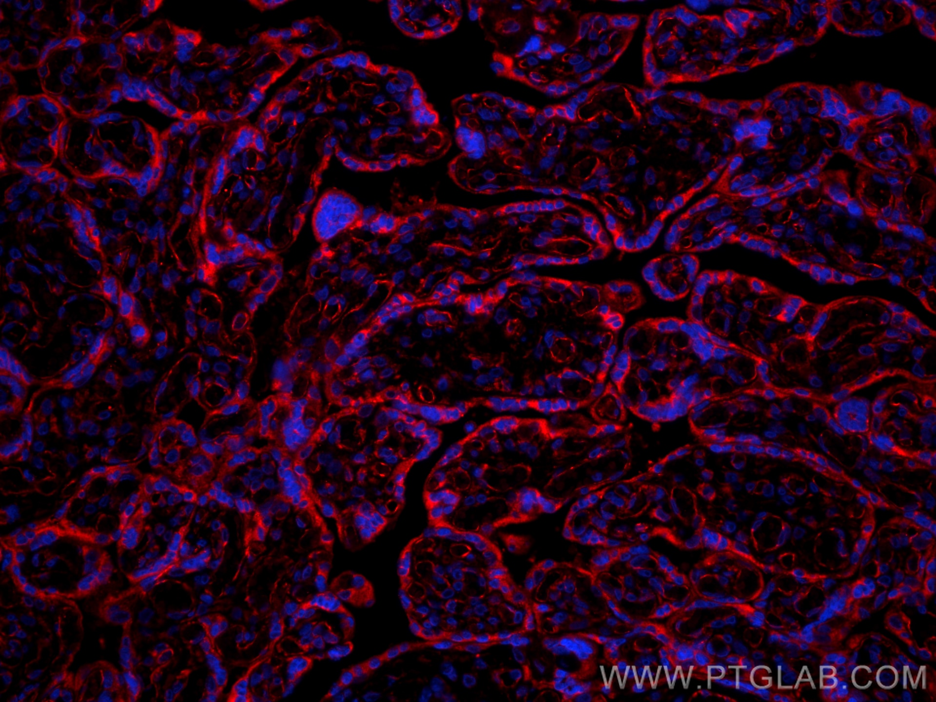 Immunofluorescence (IF) / fluorescent staining of human placenta tissue using Amphiregulin Polyclonal antibody (16036-1-AP)