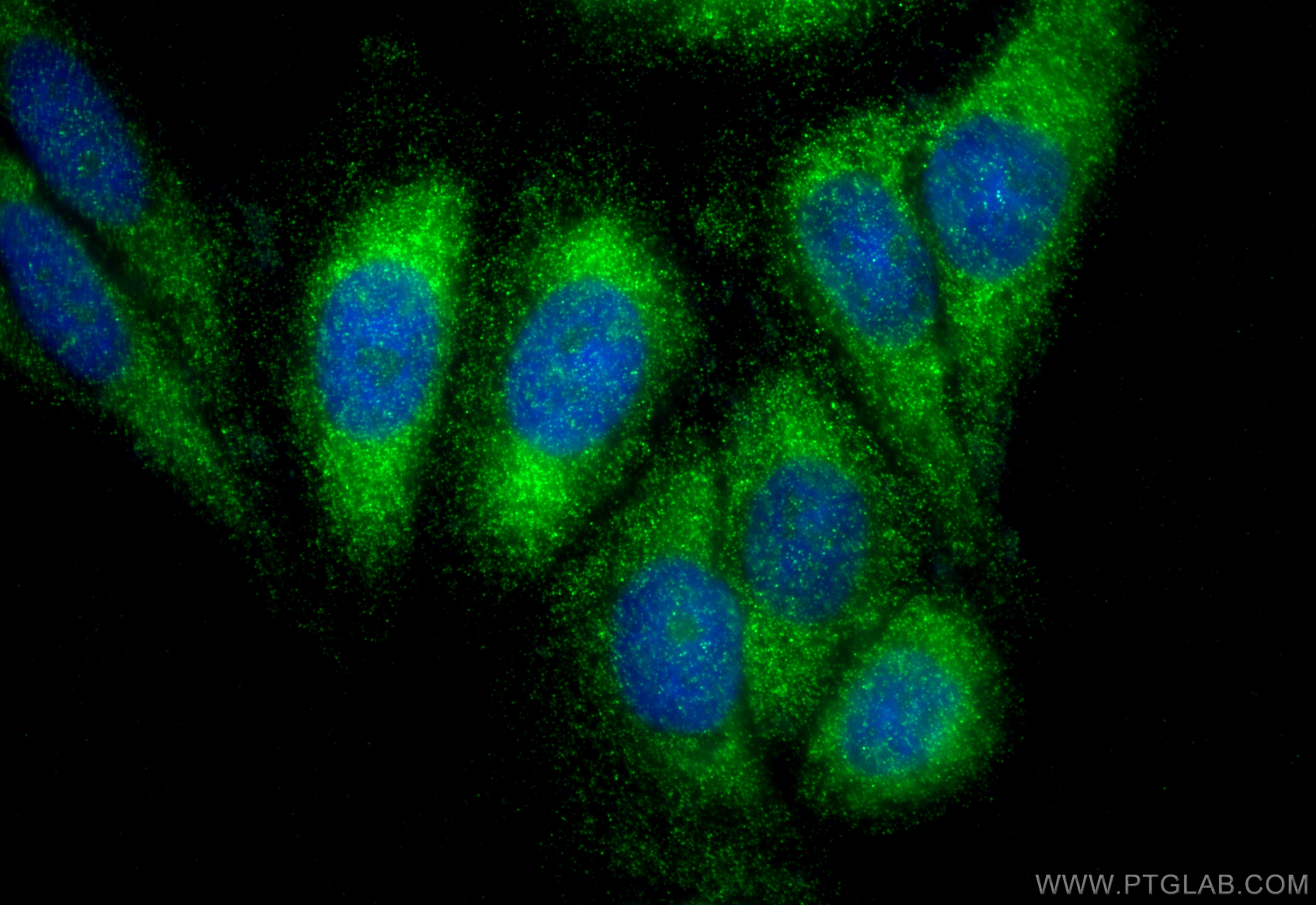 Immunofluorescence (IF) / fluorescent staining of HepG2 cells using Amphiregulin Polyclonal antibody (16036-1-AP)