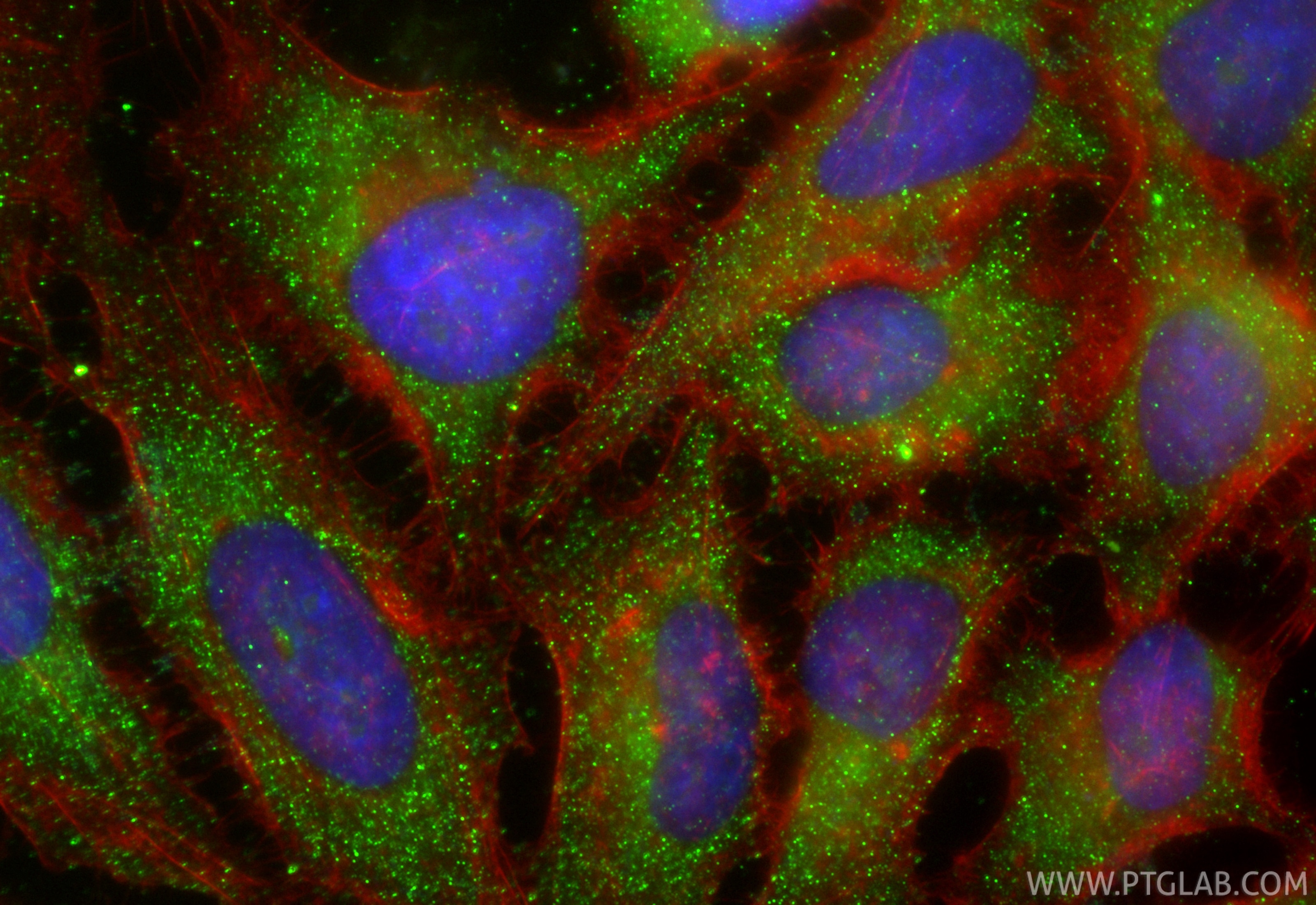 Immunofluorescence (IF) / fluorescent staining of HeLa cells using Amphiregulin Polyclonal antibody (16036-1-AP)