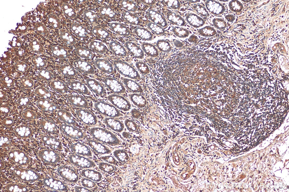 Immunohistochemistry (IHC) staining of human colon tissue using Amphiregulin Polyclonal antibody (16036-1-AP)