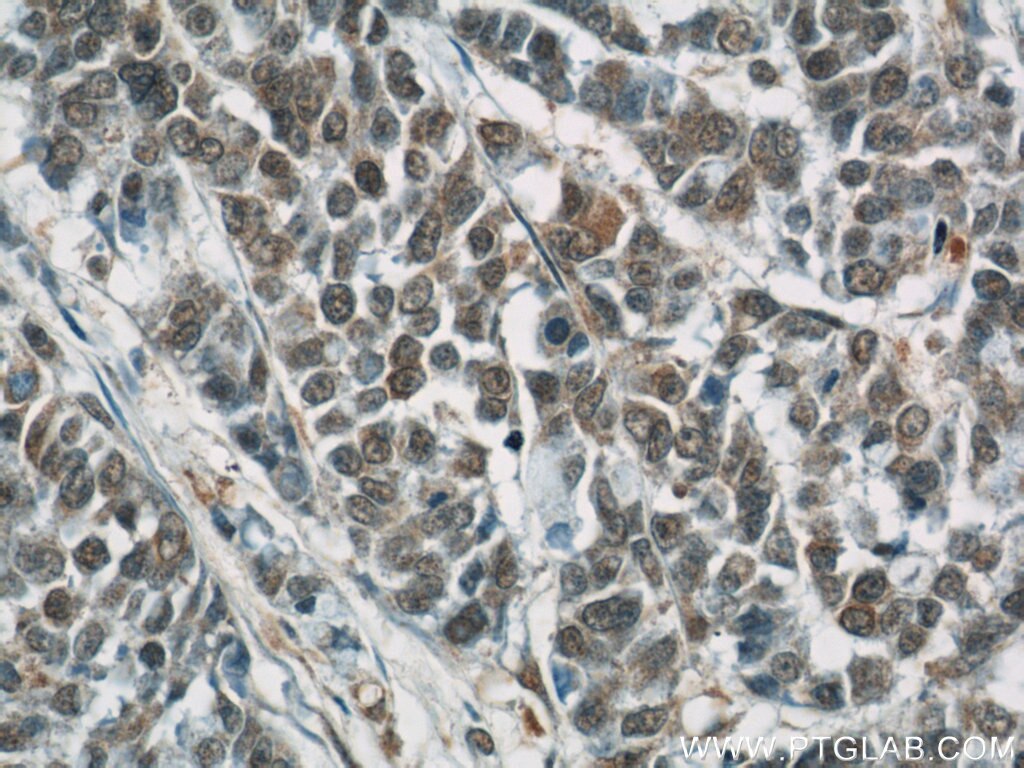 Amphiregulin Polyclonal antibody