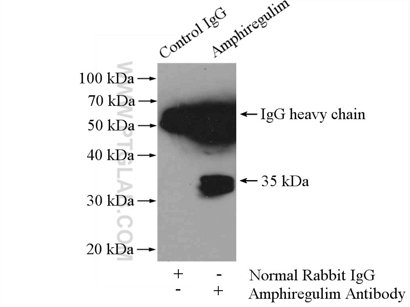 Immunoprecipitation (IP) experiment of HepG2 cells using Amphiregulin Polyclonal antibody (16036-1-AP)